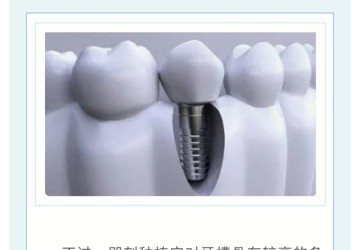 即刻种植：不是你想种就能种！