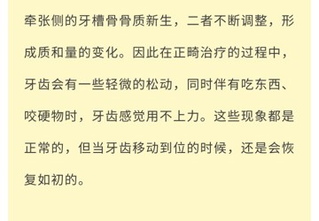 关于牙齿矫正的那些事儿