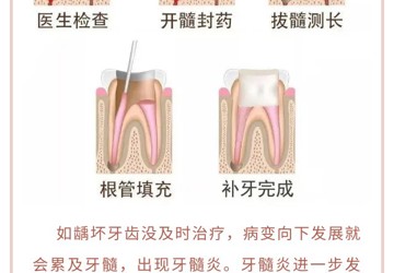 【口腔科普】补牙为什么不能一次性完成呢？