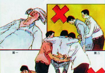 脑血管病的现场急救