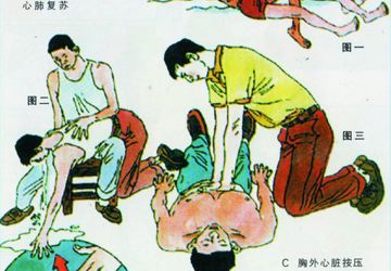 溺水的现场急救
