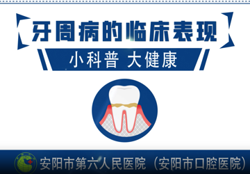 牙周病的临床表现